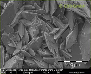 Kidney stones of calcium oxalate
