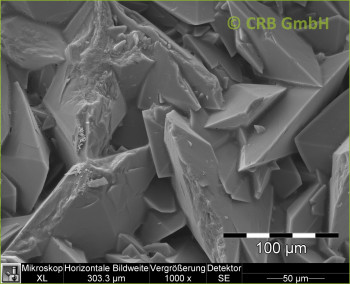 Kidney stones of calcium oxalate