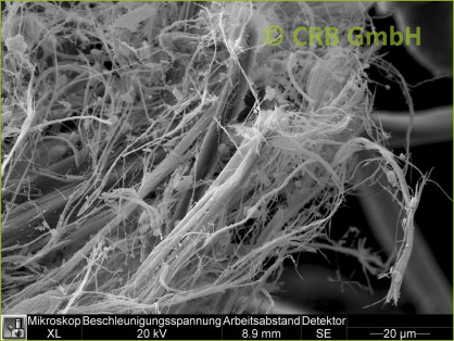 Analyse van asbest in weefsels Scanning elektronenmicroscopische opname van chrysotiel - asbest